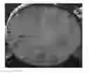 Fig. 01 - Lithium secondary battery