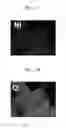 Fig. 07 - COMPOSITE CATHODE ACTIVE MATERIAL, PREPARATION METHOD THEREOF, CATHODE INCLUDING THE MATERIAL, AND LITHIUM BATTERY INCLUDING THE CATHODE