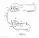 Fig. 09 - In-wall extension apparatus