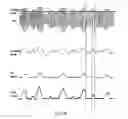 Fig. 22 - Optimization methods for amplifier with variable supply power