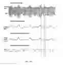 Fig. 32 - Optimization methods for amplifier with variable supply power