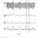 Fig. 22 - Amplifiers operating in envelope tracking mode or non-envelope tracking mode