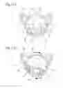 Fig. 12 - Wireless entrance communication device