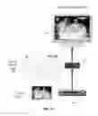 Fig. 05 - Method and apparatus for augmenting media services