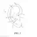 Fig. 02 - Ear jewelry with wireless audio device