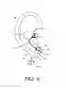 Fig. 05 - Ear jewelry with wireless audio device