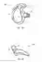 Fig. 30 - Ergonomic earpiece and attachments