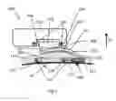 Fig. 02 - Implantable hearing aid system