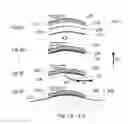 Fig. 04 - Implantable hearing aid system