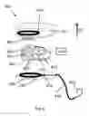 Fig. 05 - Implantable hearing aid system