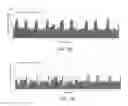 Fig. 20 - Full duplex backhaul radio with interference measurement during a blanking interval