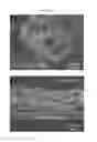 Fig. 46 - Method of manufacturing a flexible and/or stretchable electronic device