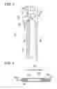 Fig. 03 - Feeder
