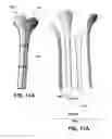 Fig. 11 - Sheathed Wick, Self Siphoning Plant Feeding Device, System and Method