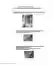 Fig. 11 - Method For Creating Endometriotic Cells And Endometriosis Model Animal