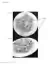 Fig. 03 - ALLERGEN-FREE AND VEGETABLE-BASED FOOD PRODUCTS AND METHODS FOR PRODUCING AND THE SAME