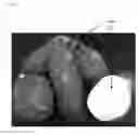 Fig. 05 - ALLERGEN-FREE AND VEGETABLE-BASED FOOD PRODUCTS AND METHODS FOR PRODUCING AND THE SAME