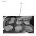 Fig. 17 - ALLERGEN-FREE AND VEGETABLE-BASED FOOD PRODUCTS AND METHODS FOR PRODUCING AND THE SAME