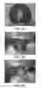 Fig. 07 - ENCAPSULATED FUNCTIONAL FOOD COMPOSITIONS
