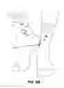 Fig. 13 - Apparatus for selectively attaching physiological sensor pod to different types of wearable apparel, and wearable apparel including the same