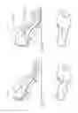 Fig. 10 - Footwear with dynamic arch system