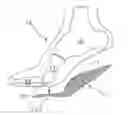 Fig. 01 - FOREFOOT CUSHION, COMPUTER PROGRAM PRODUCT FOR PROVIDING THE FOREFOOT CUSHION AND METHOD FOR PROVIDING THE FOREFOOT CUSHION