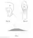 Fig. 03 - FOREFOOT CUSHION, COMPUTER PROGRAM PRODUCT FOR PROVIDING THE FOREFOOT CUSHION AND METHOD FOR PROVIDING THE FOREFOOT CUSHION
