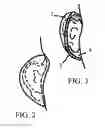 Fig. 03 - Dry Drums