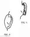 Fig. 04 - Dry Drums