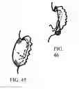 Fig. 17 - Dry Drums