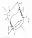 Fig. 14 - Methods, systems, and devices for combination duvet cover and comforter