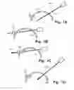 Fig. 02 - Laparoscope system