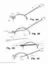 Fig. 04 - Laparoscope system