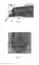 Fig. 03 - Endoscopy device