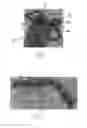 Fig. 04 - Endoscopy device
