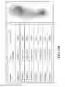 Fig. 16 - Method and apparatus for detecting and monitoring a foot pre-ulcer