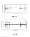 Fig. 08 - Apparatus and method for detecting heart murmurs