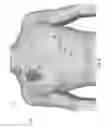 Fig. 10 - Detachable electrocardiography device
