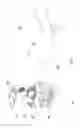 Fig. 12 - Detachable electrocardiography device