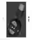 Fig. 08 - Physiological sensor pod with reset circuit