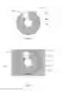 Fig. 06 - X-ray reduction system