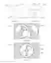Fig. 12 - X-ray reduction system
