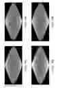 Fig. 04 - Hybrid method based on simulation and experimental data to normalize pet data