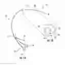 Fig. 02 - DEVICE FOR UTILIZING TRANSMISSION ULTRASONOGRAPHY TO ENABLE ULTRASOUND-GUIDED PLACEMENT OF CENTRAL VENOUS CATHETERS