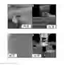 Fig. 08 - DEVICE FOR UTILIZING TRANSMISSION ULTRASONOGRAPHY TO ENABLE ULTRASOUND-GUIDED PLACEMENT OF CENTRAL VENOUS CATHETERS