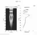 Fig. 06 - METHOD FOR PRODUCING ELASTIC IMAGE AND ULTRASONIC DIAGNOSTIC APPARATUS