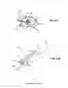 Fig. 40 - DEVICES, SYSTEMS, AND HYBRID METHODS FOR ATRIAL APPENDAGE OCCLUSION USING LIGHT CURE