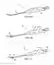 Fig. 03 - Articulating suturing device and method