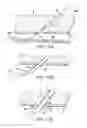 Fig. 13 - Articulating suturing device and method