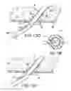 Fig. 14 - Articulating suturing device and method